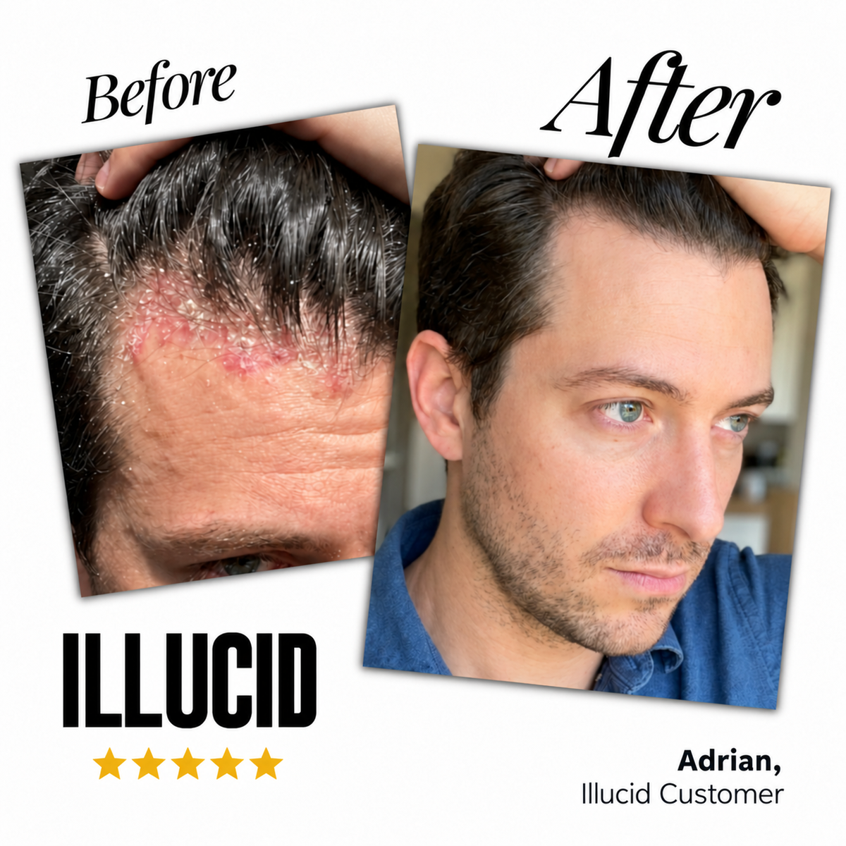 Illucid Natural Calming Serum