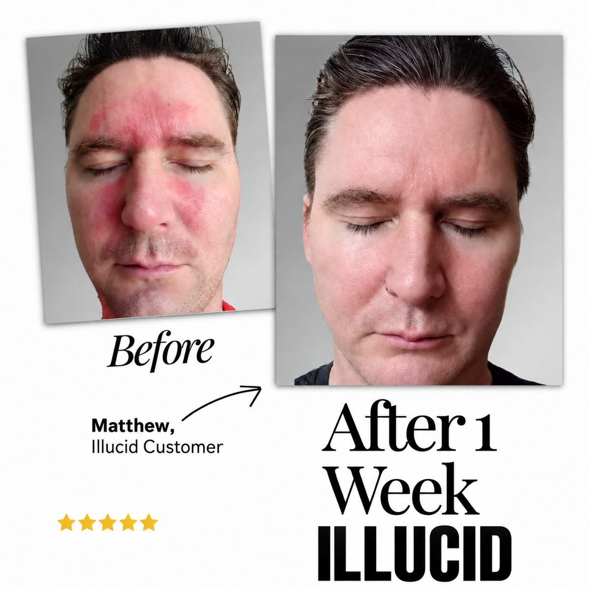 Illucid Natural Calming Serum