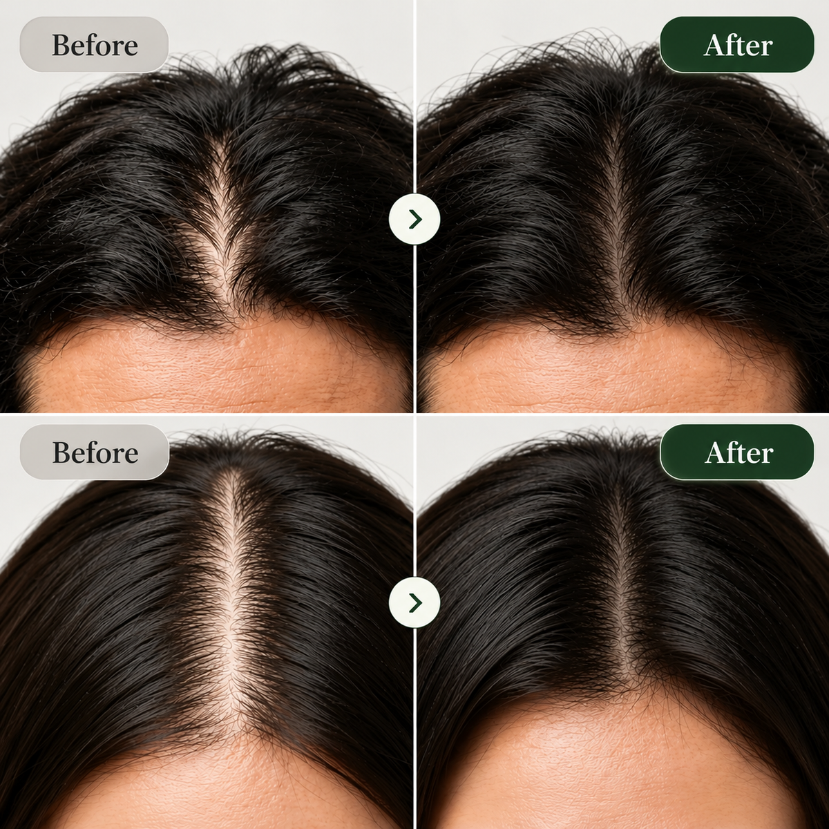 Korean Scalp Revival Bar