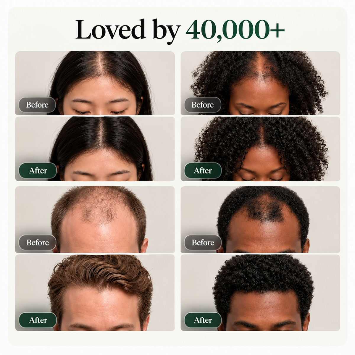 Korean Scalp Revival Bar