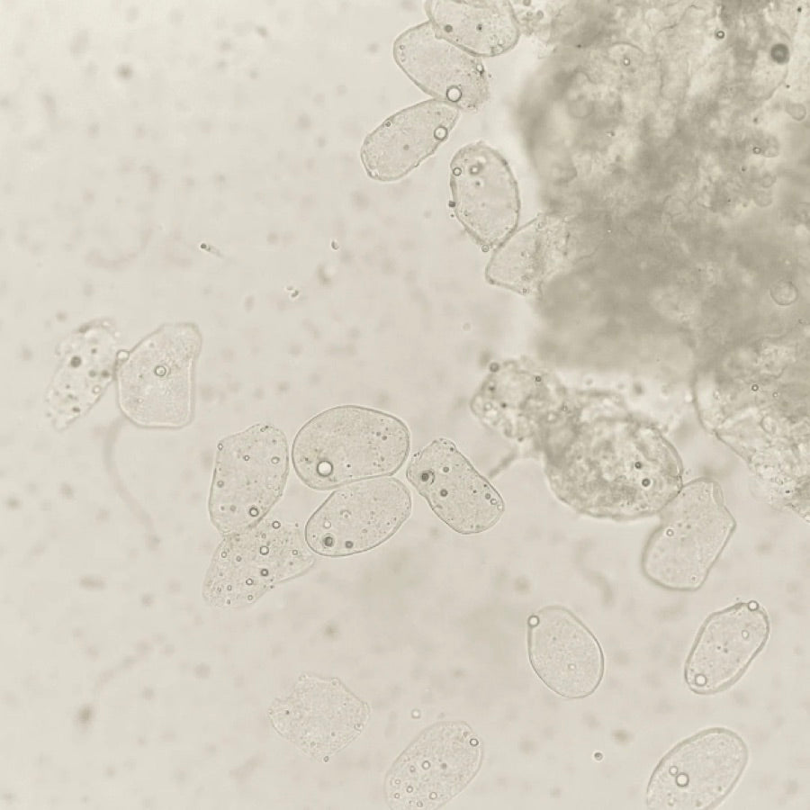Microscope view of Malassezia yeast cells